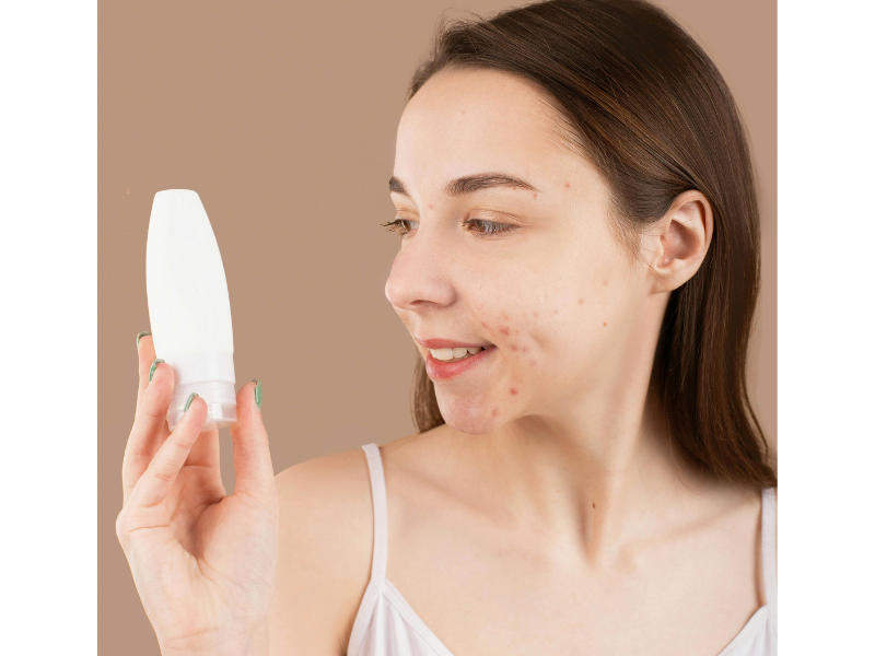 Best ingredients for acne-prone skin including salicylic acid, niacinamide, and benzoyl peroxide